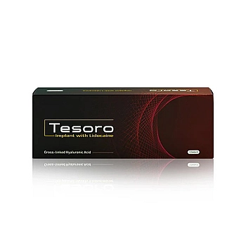 Tesoro Implant with Lidocaine 1.1ml (2 syringes x 1.1ml)